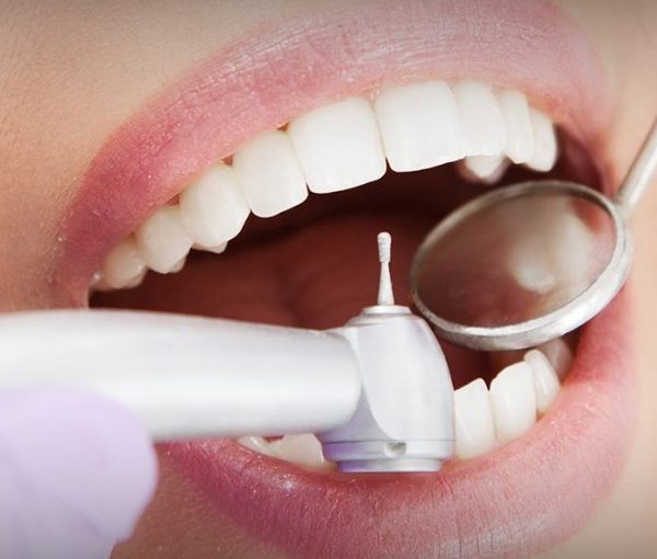 Dentística – ABO-PR – Associação Brasileira de Odontologia